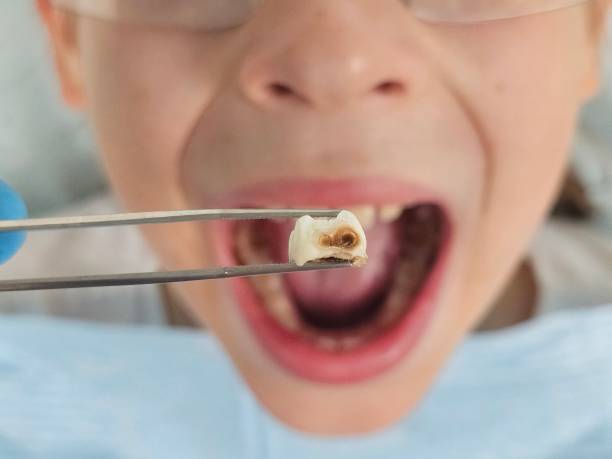 Best Broken or Cracked Tooth Emergency Dentist in Oli, PA